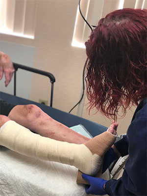 Wrapping-wounded-leg Wrapping wounded leg