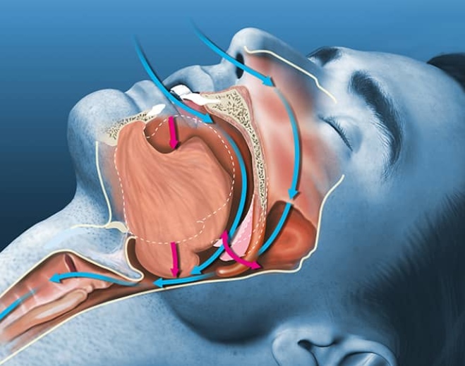 Medical illustration of airway anatomy